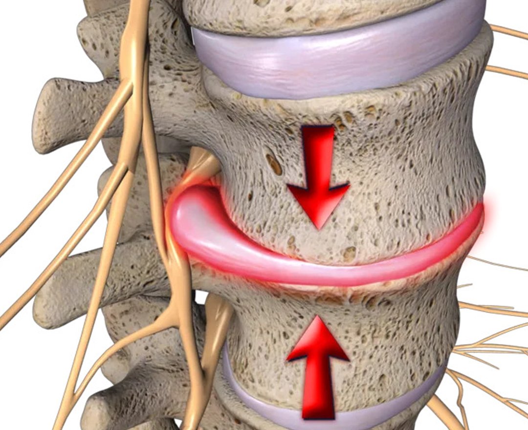 Healthcare consultation
